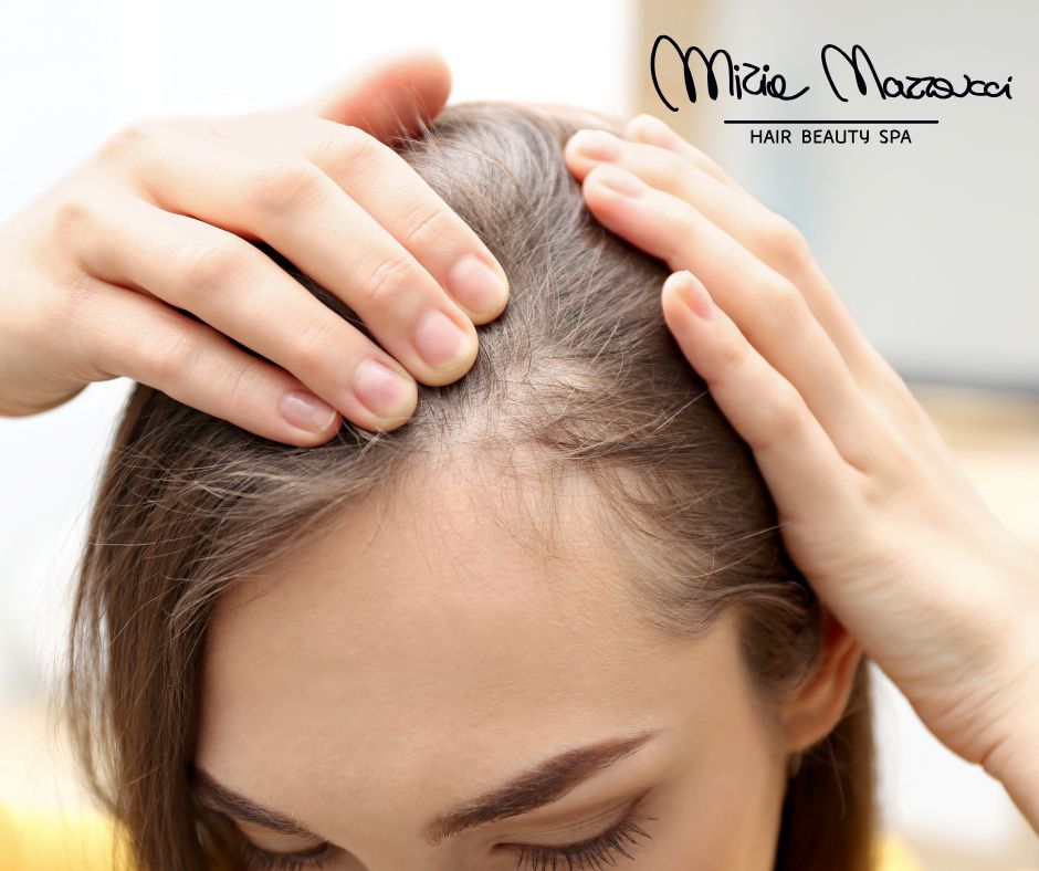 donna che mostra la perdita dei capelli a ridosso della fronte